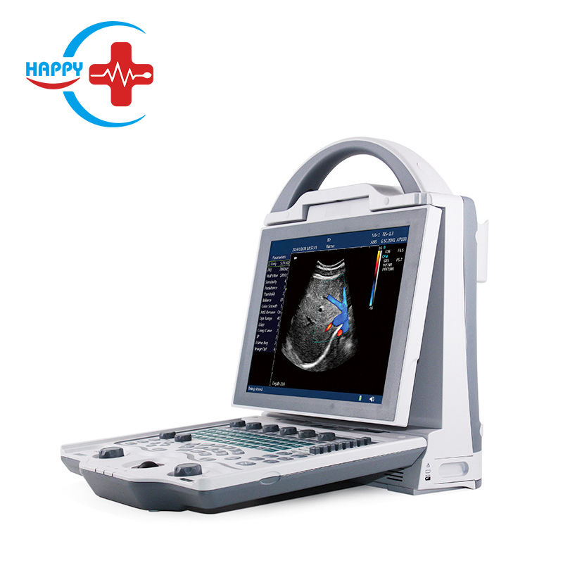 Digital pregnancy use color doppler ultrasound machine