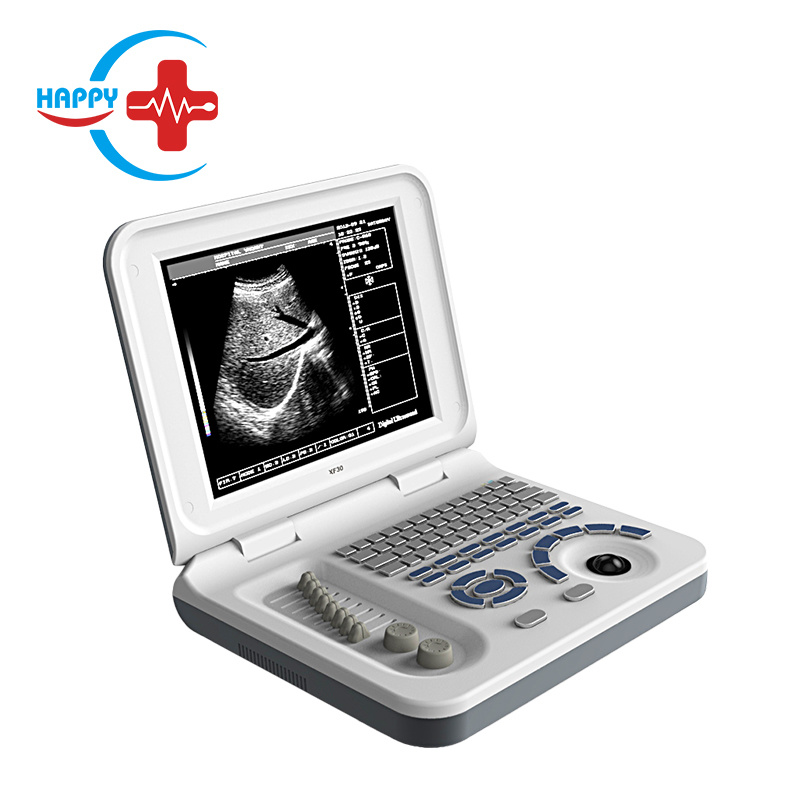 Laptop full digital portable ultrasound scanner