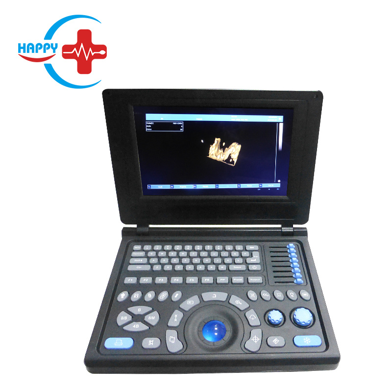 10.4/12 inch screen color LCD PC system laptop ultrasound scanner