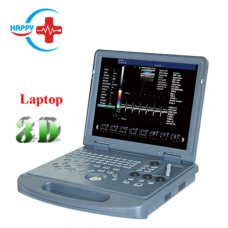 Hot sale 3D laptop color doppler ultrasonic diagnostic machine