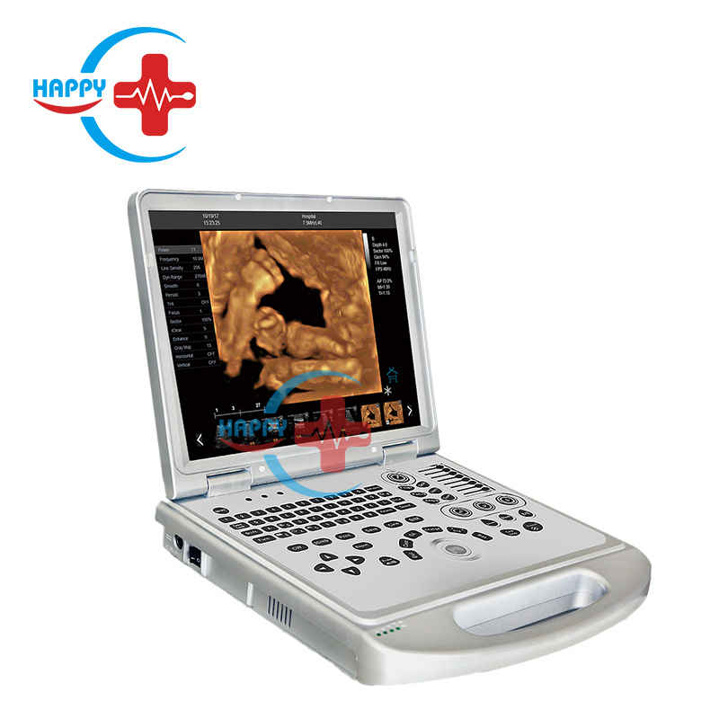 Portable medical 3D color doppler 15 inch LED laptop ultrasound scanner