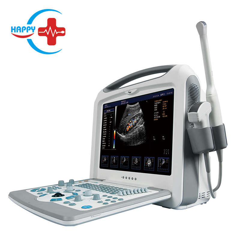 Hospital diagnosis equipment laptop 2D full digital color doppler ultrasound machine
