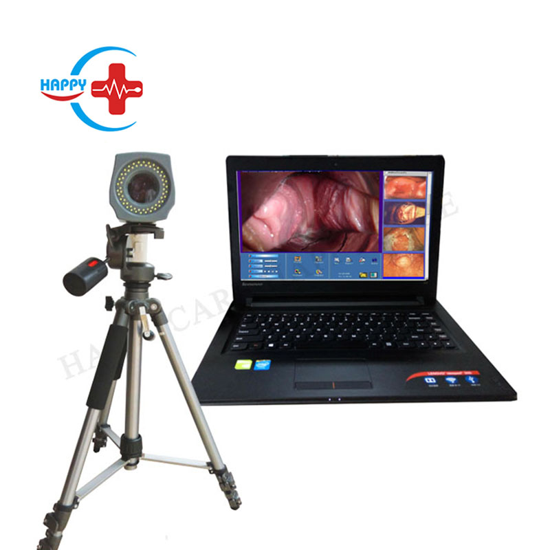 Medical Laptop Digital Video Colposcope